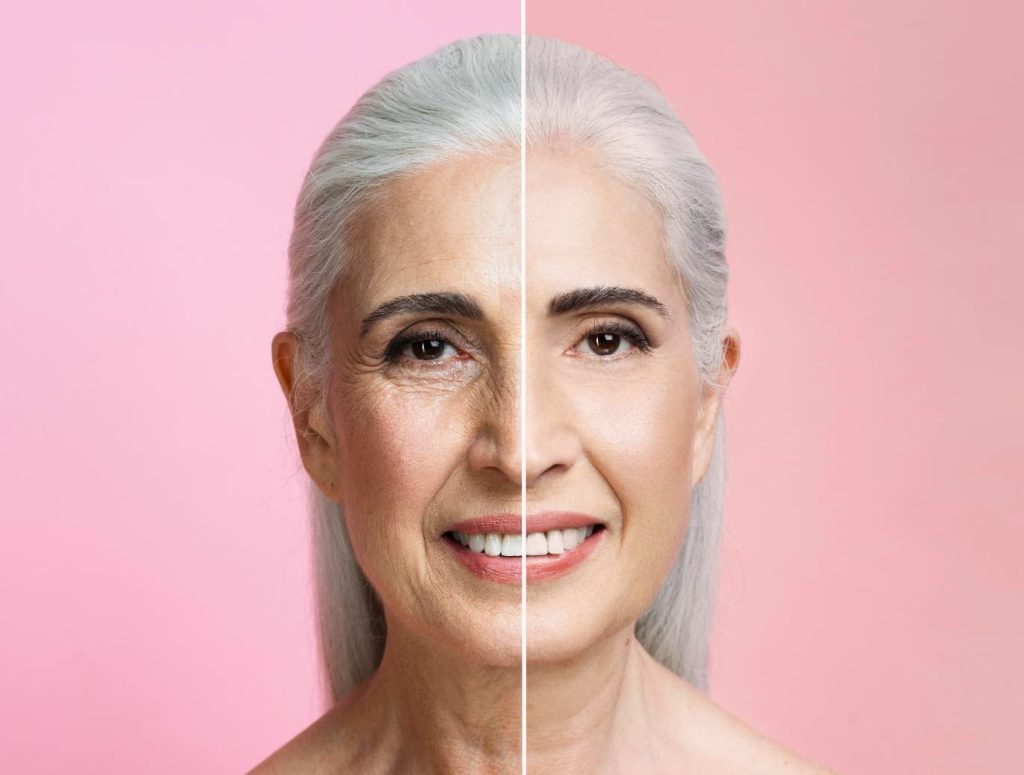 Aging Skin